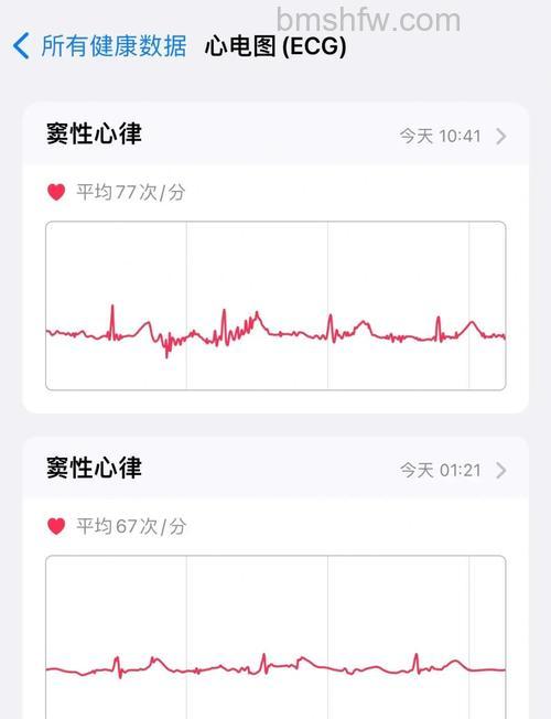 Apple Watch7心电图数据在哪看：查看步骤详解