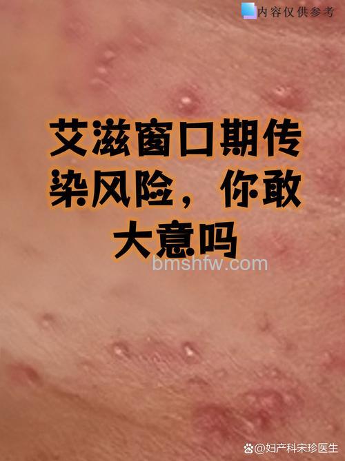 隐形门病毒是什么